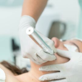 Microneedling